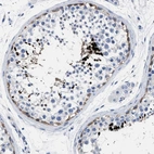 Immunohistochemical staining of human testis shows strong nuclear positivity in cells in seminiferous ducts.