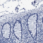 Immunohistochemical staining of human colon shows no positivity in glandular cells as expected.