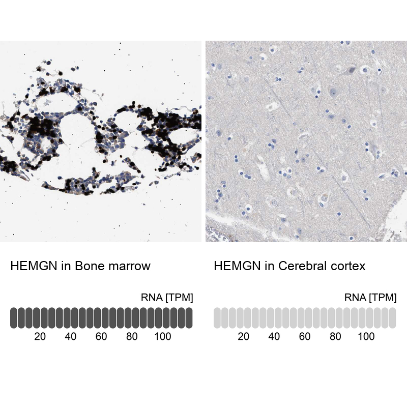 Anti-HEMGN Antibody
