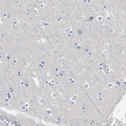Immunohistochemical staining of human cerebral cortex shows no positivity in neurons as expected.