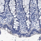 Immunohistochemical staining of human colon shows no positivity in glandular cells as expected.