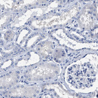 Immunohistochemical staining of human kidney shows no positivity in cells in tubules.
