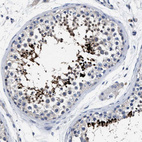 Immunohistochemical staining of human testis shows strong nuclear positivity in cells in seminiferous ducts.