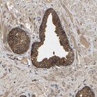 Anti-LPAR2 Antibody