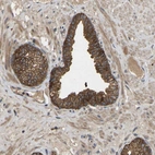 Anti-LPAR2 Antibody
