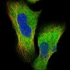 Immunofluorescent staining of human cell line U-2 OS shows localization to cytosol.