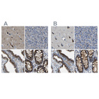 Immunohistochemical staining of human cerebral cortex, pancreas, prostate and rectum using Anti-CANT1 antibody HPA019627 (A) shows similar protein distribution across tissues to independent antibody HPA019639 (B).