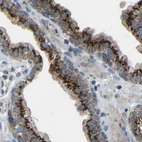 Immunohistochemical staining of human prostate using Anti-CANT1 antibody HPA019627.