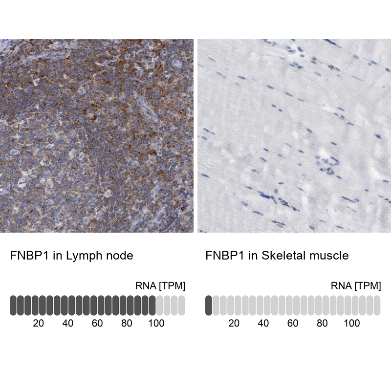 Anti-FNBP1 Antibody