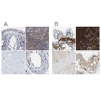 Immunohistochemical staining of human colon, lymph node, skeletal muscle and testis using Anti-FNBP1 antibody HPA019635 (A) shows similar protein distribution across tissues to independent antibody HPA019691 (B).