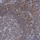 Immunohistochemical staining of human lymph node shows high expression.