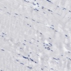 Immunohistochemical staining of human skeletal muscle shows low expression as expected.