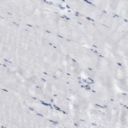 Immunohistochemical staining of human skeletal muscle shows low expression as expected.