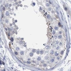 Immunohistochemical staining of human testis using Anti-FNBP1 antibody HPA019635.
