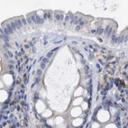 Immunohistochemical staining of human colon using Anti-FNBP1 antibody HPA019635.