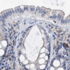 Immunohistochemical staining of human colon using Anti-FNBP1 antibody HPA019635.