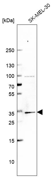 Anti-BRMS1 Antibody