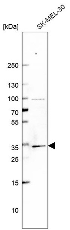 Anti-BRMS1 Antibody