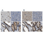 Immunohistochemical staining of human cerebral cortex, pancreas, prostate and rectum using Anti-CANT1 antibody HPA019639 (A) shows similar protein distribution across tissues to independent antibody HPA019627 (B).
