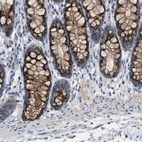 Immunohistochemical staining of human rectum shows high expression.