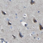 Immunohistochemical staining of human cerebral cortex using Anti-CANT1 antibody HPA019639.