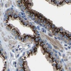 Immunohistochemical staining of human prostate using Anti-CANT1 antibody HPA019639.