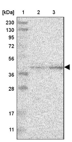 Lane 1: Marker [kDa] 230, 130, 95, 72, 56, 36, 28, 17, 11_br/_Lane 2: Human cell line RT-4_br/_Lane 3: Human cell line U-251MG sp