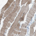 Immunohistochemical staining of human skeletal muscle shows moderate cytoplasmic positivity in myocytes.