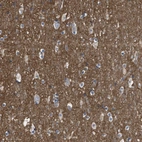 Immunohistochemical staining of human cerebral cortex shows moderate positivity in neuropil.