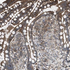 Immunohistochemical staining of human colon shows moderate cytoplasmic positivity in glandular cells.