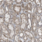 Immunohistochemical staining of human kidney shows weak to moderate cytoplasmic and membranous positivity in cells in tubules.