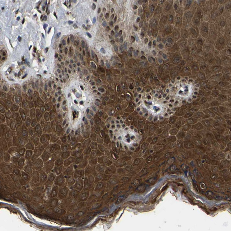 Anti-TRIM35 Antibody