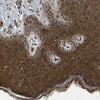 Anti-TRIM35 Antibody