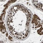 Immunohistochemical staining of human testis shows strong nuclear and cytoplasmic positivity in cells in seminiferous ducts and leydig cells.