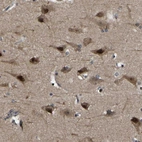 Immunohistochemical staining of human cerebral cortex shows strong nuclear and cytoplasmic positivity in neuronal cells.