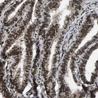 Immunohistochemical staining of human fallopian tube shows strong nuclear and cytoplasmic positivity in glandular cells.