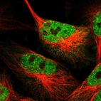 Immunofluorescent staining of human cell line U-251 MG shows localization to nucleoplasm.