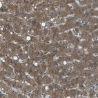 Anti-AKR1A1 Antibody