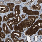 Immunohistochemical staining of human kidney shows strong cytoplasmic positivity in cells in tubules.