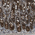 Immunohistochemical staining of human duodenum shows strong cytoplasmic positivity in glandular cells.