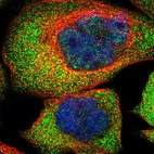 Immunofluorescent staining of human cell line A-431 shows localization to nucleoplasm & cytosol.