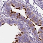 Immunohistochemical staining of human fallopian tube using Anti-ANXA13 antibody HPA019650.