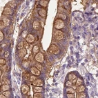 Immunohistochemical staining of human small intestine using Anti-ANXA13 antibody HPA019650.