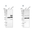 Western blot analysis using Anti-ANXA13 antibody HPA019650 (A) shows similar pattern to independent antibody HPA018535 (B).