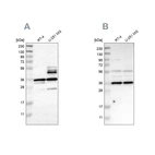 Western blot analysis using Anti-ANXA13 antibody HPA019650 (A) shows similar pattern to independent antibody HPA018535 (B).