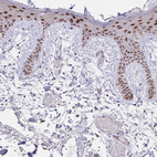Immunohistochemical staining of human skin shows moderate to strong nuclear positivity in keratinocytes.