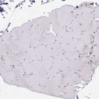 Immunohistochemical staining of human skeletal muscle shows no positivity in myocytes.