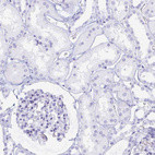 Immunohistochemical staining of human kidney shows no positivity in cells in tubules.