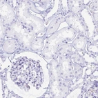 Immunohistochemical staining of human kidney shows no positivity in cells in tubules.