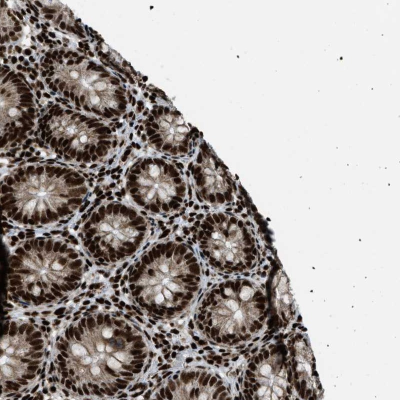 Anti-GABPB1 Antibody